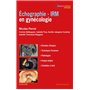 Echographie - IRM en gynécologie