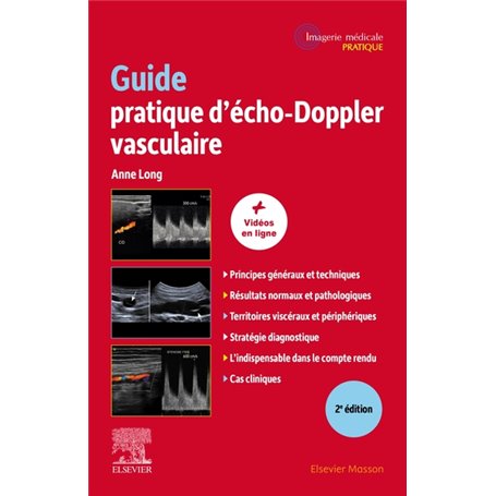 Guide pratique d'écho-Doppler vasculaire