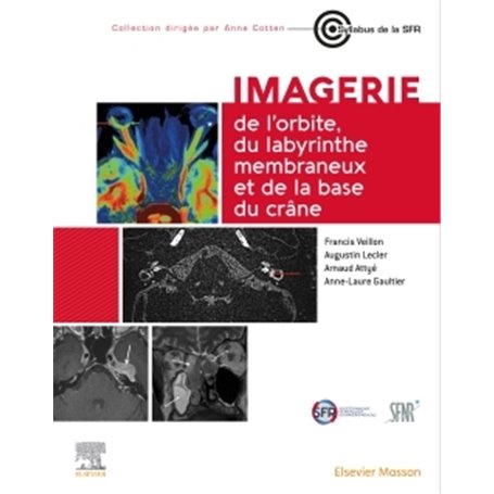 Imagerie de l'orbite, du labyrinthe membraneux et de la base du crâne