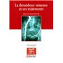 Thrombose Veineuse