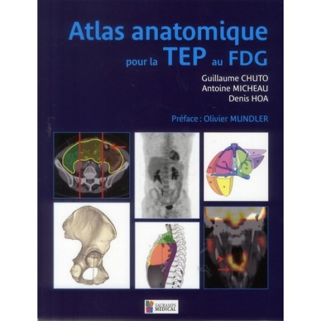 ATLAS ANATOMIQUE POUR LA TEP AU FDG