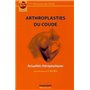 ARTHROPLASTIES DU COUDE. ACTUALITES THERAPEUTIQUES