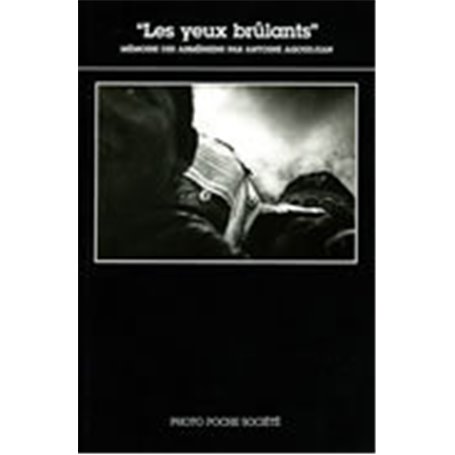 Les Yeux brûlants