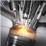 Bosch ZR6SPP302 - Bougies d'allumage Platinum - 1 bougie