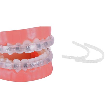 Protège-Lèvres Pour Appareil Dentaire - remplace la Cire Orthodontique - Protège-dents orthodontique pour accolades