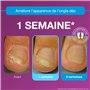 EMTRIX - Traitement Mycose Ongle Pied - Formule Brevetée - Résultat Dès 1 Semaine Cliniquement Prouvé - Réduit La Décoloration, 