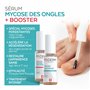 PODERM - LOT MYCOSE ONGLE SEVÈRE 2 PRODUITS | 2 Best Sellers | Traitement complet spécial Mycose difficile à traiter | Soin prof