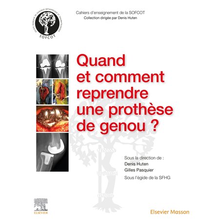 Quand et comment reprendre une prothèse de genou ? 116,44 €