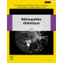 Rétinopathie diabétique