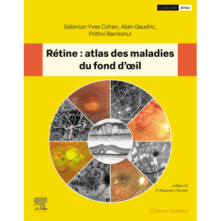 Rétine : atlas des maladies du fond d'oeil