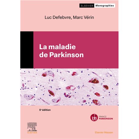 La maladie de Parkinson