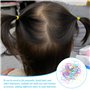 50 Mini Pinces À Cheveux Papillon Et 100 Élastiques En Caoutchouc, Jolies Pinces À Cheveux, Accessoires Pour Cheveux Pour Enfant