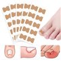 Lot de 50 patchs de correction des ongles incarnés sans colle pour ongles d'orteils pour soins des pieds