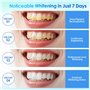 28 Bandes de Blanchiment Dentaire Professionnelles, Élimine les Taches Profondes Café/Tabac/Vin/Soda,Résultats Visibles,Blanchim