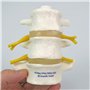 3B Scientific® Modèle de 3 Vertèbres Lombaires – Segment Vertébral Taille Réelle avec Disques Intervertébraux, Montage Flexible 