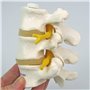 3B Scientific® Modèle de 3 Vertèbres Lombaires – Segment Vertébral Taille Réelle avec Disques Intervertébraux, Montage Flexible 