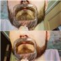 Ensemble de 5 tailles pour barbe de chèvre - Outil de façonnage de barbe - Modèle de rasage tendance pour homme