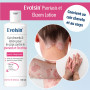 Evolsin® Lotion psoriasis & eczéma pour le cuir chevelu et le corps - pour les peaux irritées, sèches I Cicatrise & soulage les 