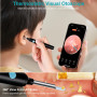 AiQInu Otoscope Oreille 1080P HD Camera Iscope Étanche Nettoyant Oreille Avec 6 Lumières LED Outil de Nettoyage d'oreille Adapté
