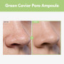 TOSOWOONG Ampoule à pores de caviar vert avec minimisateur de pores au niacinamide au caviar vert de 2500 ppm, 33ml, 1,11 fl.oz.