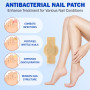 Patchs pour les Mycoses des Ongles (21 pièces), Traitement et Réparation des Mycoses des Ongles des Pieds, Multi-usages pour les