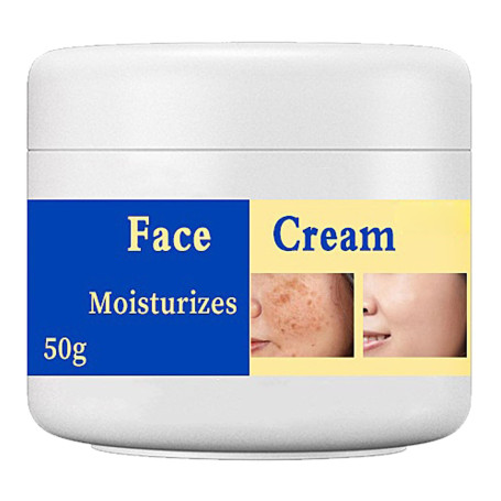 KOAHDE Crème Eclaircissante pour Peau Foncée,Eclaircissante de la Peau,Crèmes Eclaircissantes Anti-Taches de Rousseur,Eliminateu