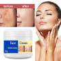 KOAHDE Crème Eclaircissante pour Peau Foncée,Eclaircissante de la Peau,Crèmes Eclaircissantes Anti-Taches de Rousseur,Eliminateu