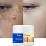 KOAHDE Crème Eclaircissante pour Peau Foncée,Eclaircissante de la Peau,Crèmes Eclaircissantes Anti-Taches de Rousseur,Eliminateu