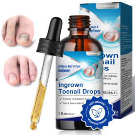 30ml Professionnel Soin D’ongle, Mycose de l'ongle,Pour Les Ongles Décolorés Épaissis,Contre la Mycose de l'ongle Persistante, A