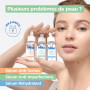 Mixa Sérum Concentré Anti-Imperfections, Sérum Visage avec Niacinamide et Acide Salicylique - Réduit Boutons, Points Noirs, Pore