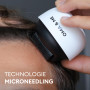 OMA & ME Derma Roller 0.5 mm - Stimule la Pousse des Cheveux Naturellement, Favorise la Croissance du Cuir Chevelu - Microneedli