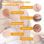 20g Cicatrice gel, Baume pour cicatrices, Crème apaisante, Favorise la réparation des peaux abîmées et asséchées, pour une peau