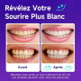 Bande Blanchiment Dentaire Violet, Bandes Blanchissantes pour Dents: 14 Bandes Violettes 7 Paires, Résultat Rapide, Élimine Tach