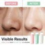 XENQITO 3 Pièces Outil pour Enlever les Points Noirs, Silicone pour le Nez Grattoir pour Points Noirs Spatule pour le Visage Net