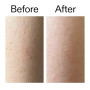 The Inkey List Glycolic Acid Exfoliating Body Stick 45g | Multiple Concerns, One Targeted Solution | Delivers Deep, Effective Ex